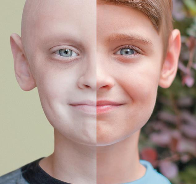 Picture 2 of Why are more men dying of cancer than women?