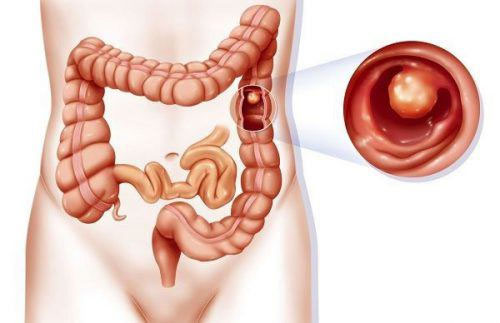 Picture 2 of Why are you feeling nauseous but not vomiting?