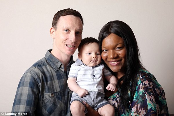 Picture 2 of Why do black parents have blue, white eyes?