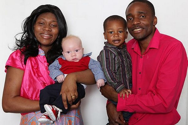 Picture 4 of Why do black parents have blue, white eyes?