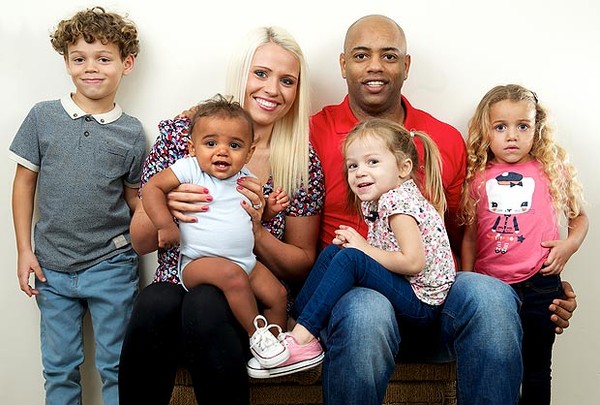 Picture 5 of Why do black parents have blue, white eyes?