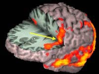 Picture 1 of Why do blind people usually have good hearing?