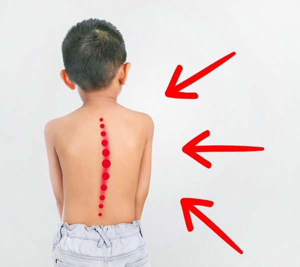 Picture 3 of Why do children often walk on the toes?