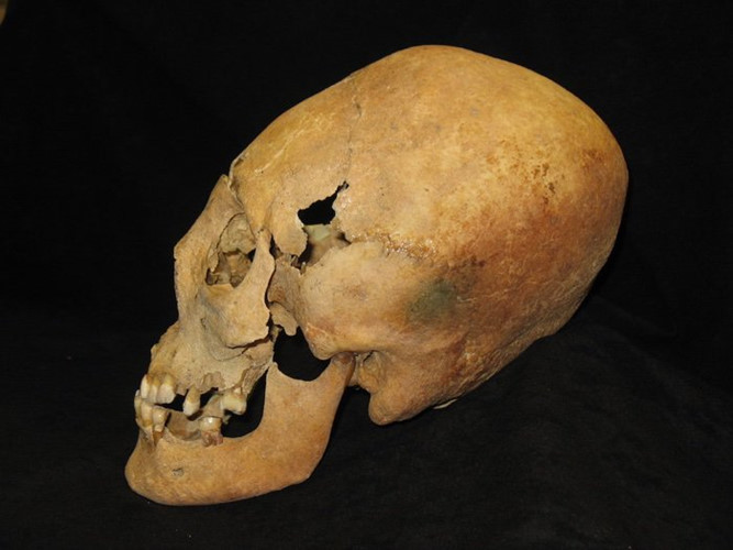 Picture 8 of Why do medieval women have an alien-like skull?