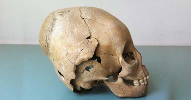 Picture 9 of Why do medieval women have an alien-like skull?