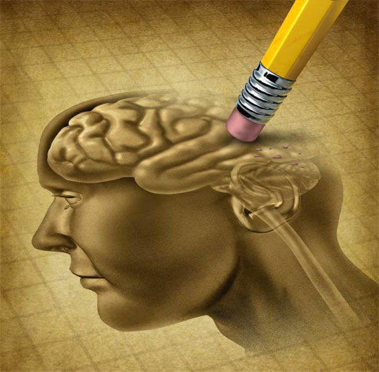 Picture 4 of Why do women have Alzheimer's disease more than men?