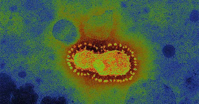 Picture 3 of Why does corona virus scare many people even with low death rate?