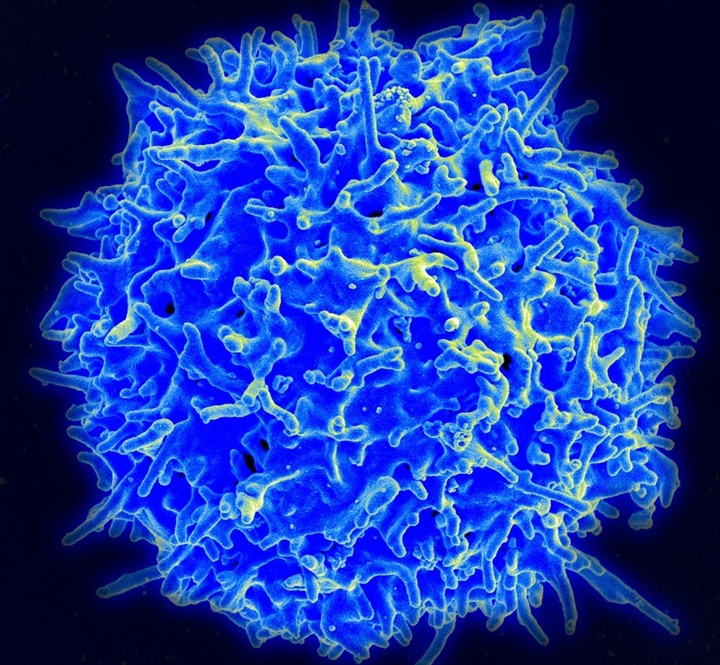 Picture 4 of Why does flu make you uncomfortable?