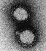 Picture 2 of Why does the flu virus proliferate in winter?