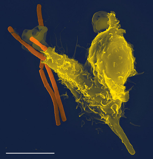 Picture 2 of Why is 3BNC117 antibody a new hope for HIV treatment?