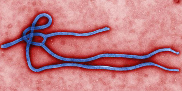 Picture 1 of Why is Ebola virus increasingly dangerous?