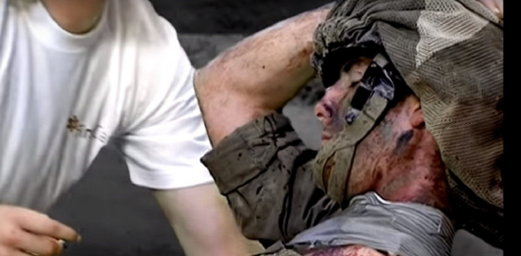 Picture 2 of Why is it easy to die in the neck of victims?
