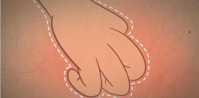 Picture 1 of Why is it so easy to scratch itch?