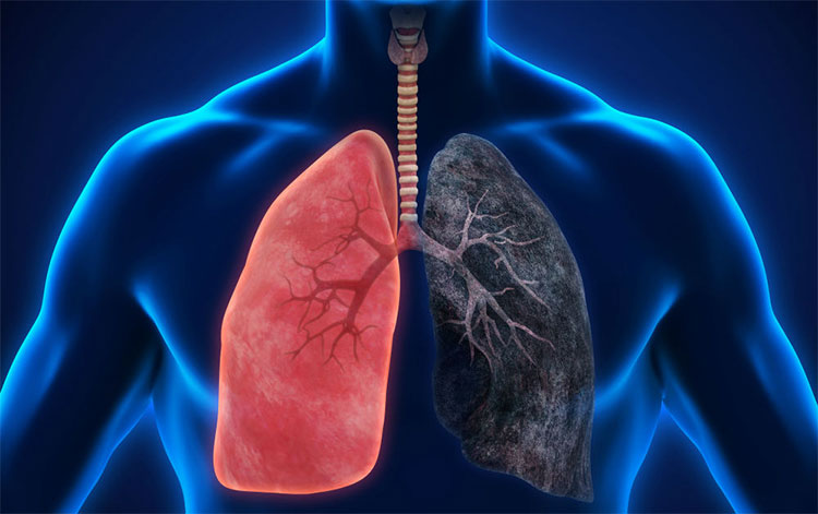 Why is lung cancer dangerous?