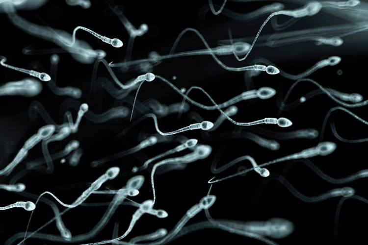 Picture 3 of Why is sperm dysfunction?
