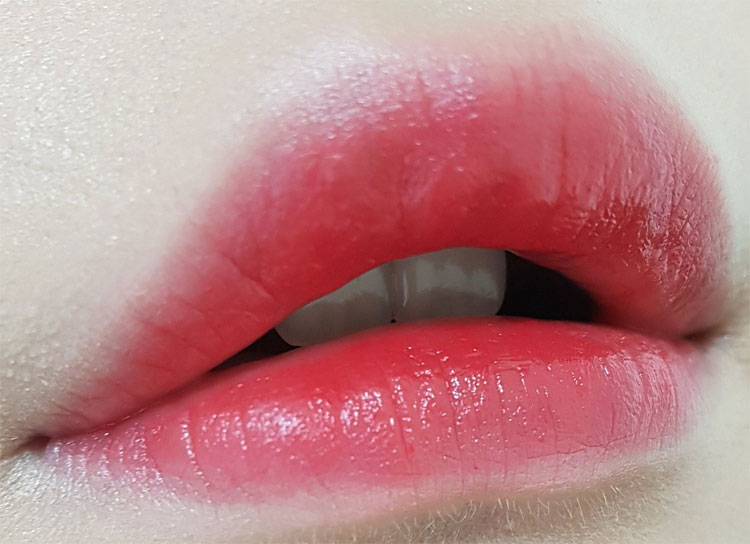 Picture 1 of Why is the skin of the lips not the same as other skin areas?