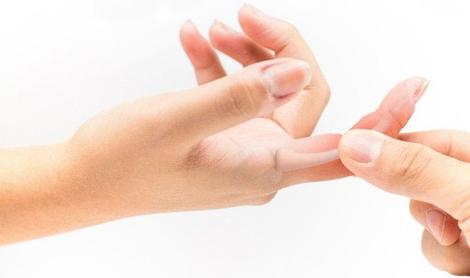 Picture 1 of Why jointing finger pain?