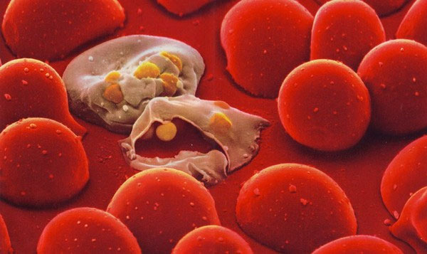 Picture 4 of Why only 1 bite can cause blood infection to take one's life?