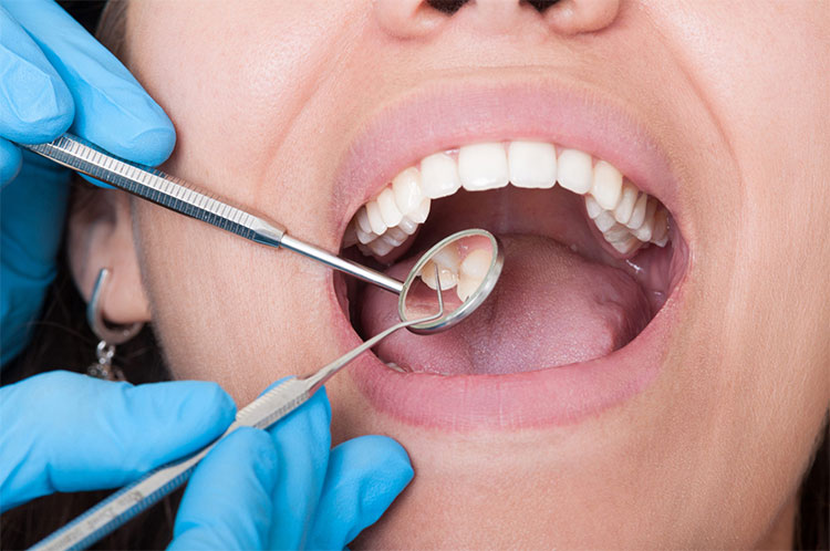 Picture 1 of Why should a dental examination be performed before cancer surgery?