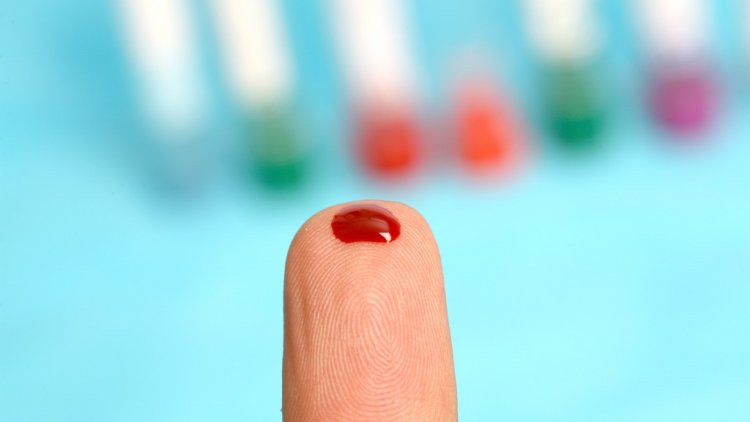 Picture 1 of Why split into blood groups and tragic history stories