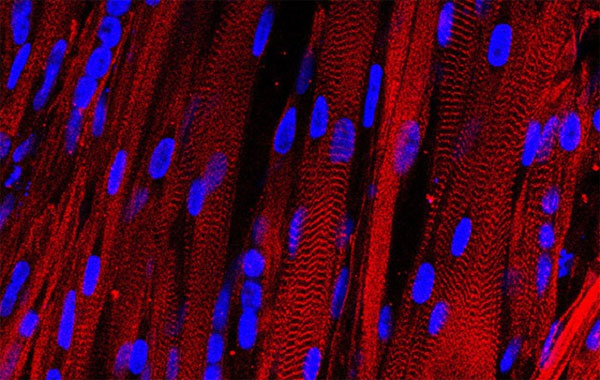 Picture 1 of Will artificial muscles be used to test drugs?