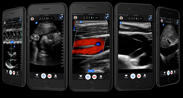 Picture 2 of Will mobile ultrasound detect a revolution?