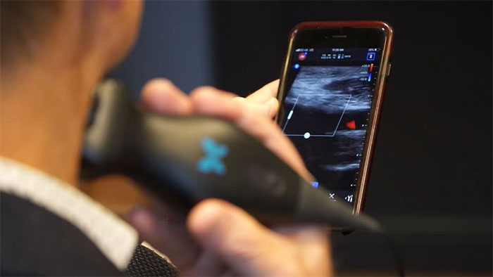 Picture 4 of Will mobile ultrasound detect a revolution?
