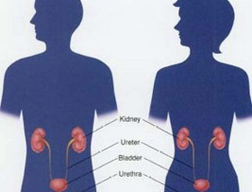 Picture 1 of Women die earlier than men because of bladder cancer