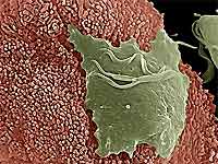 Women with whip infection may be infertile images 1