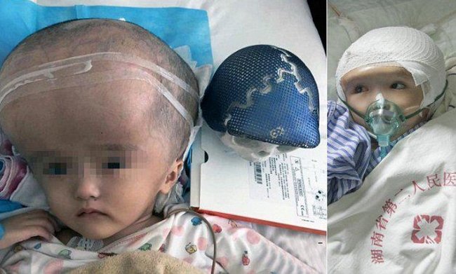 Picture 2 of World outstanding medical achievements in 2015