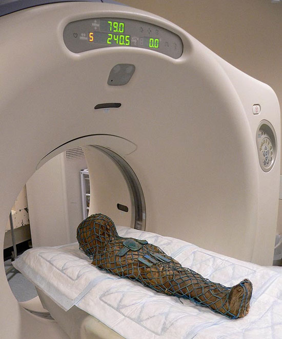Picture 1 of X-ray film reveals the secret of a thousand-year-old coffin
