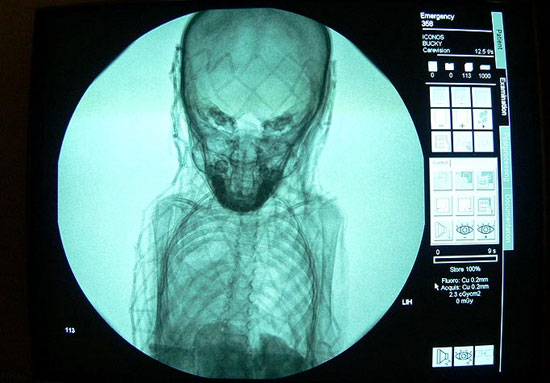 Picture 2 of X-ray film reveals the secret of a thousand-year-old coffin