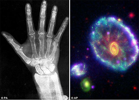 Picture 1 of X-rays affect the most scientific progress
