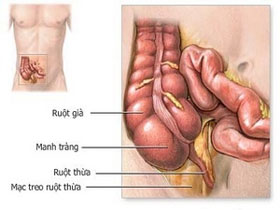 Picture 1 of You may not know: Appendicitis is caused by a virus