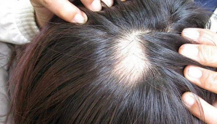 Picture 3 of You will no longer abuse dry shampoo after reading this article