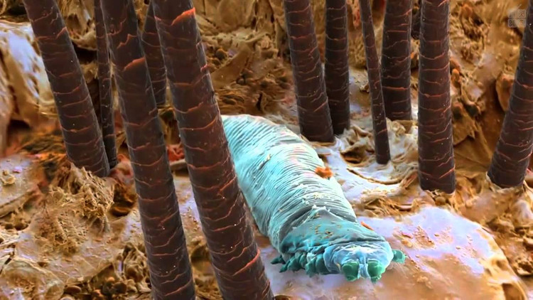 Picture 6 of You won't believe these horrific images are your body