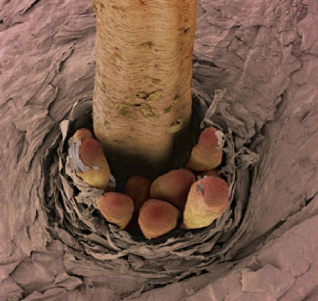 Picture 7 of You won't believe these horrific images are your body