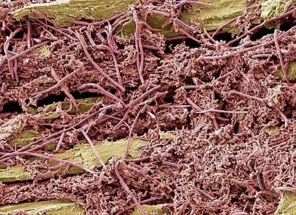 Picture 9 of You won't believe these horrific images are your body