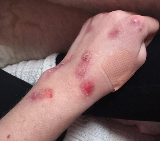 Picture 2 of Young girl with strange disease