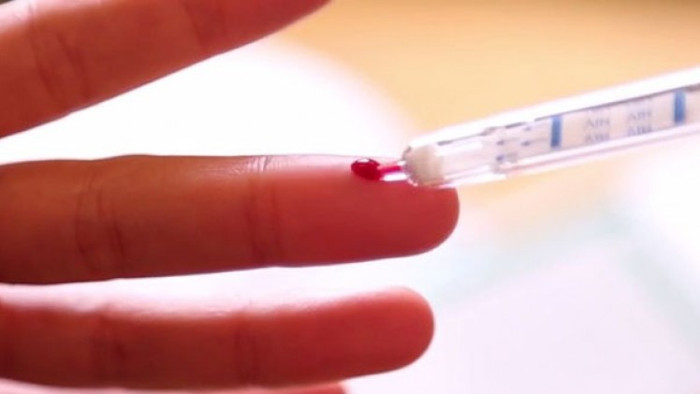 Picture 4 of £ 10 million for anyone to find a solution against antibiotic resistance