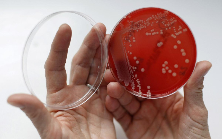Picture 5 of £ 10 million for anyone to find a solution against antibiotic resistance
