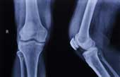 10 interesting things about the human skeleton