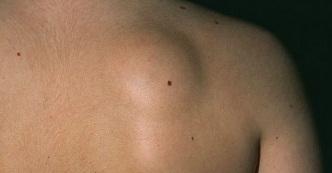 10 signs of cancer are growing in the body, everyone must be satisfied