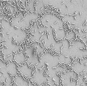 10 years from now there will be microbial electricity