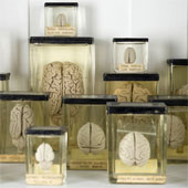100 brains disappear mysteriously