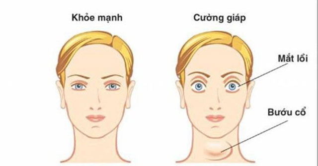 11 complications of unpredictable dangerous thyroid failure need to know