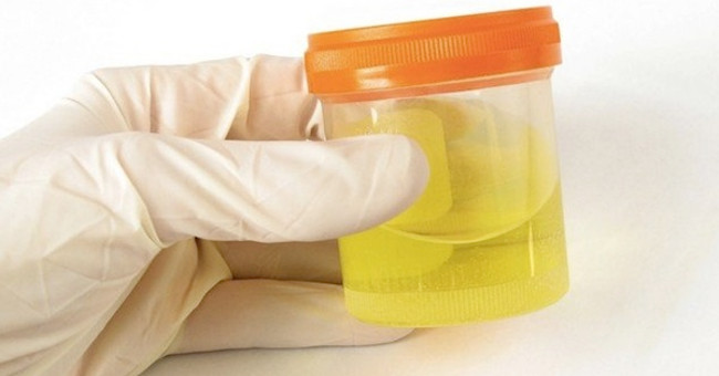 13 surprisingly interesting things about urine