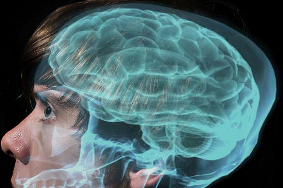 150 brains for autism research are destroyed