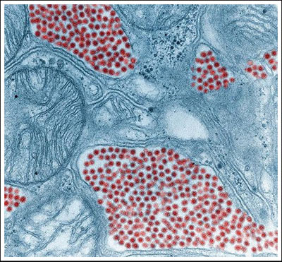 200 Indian children die from encephalitis