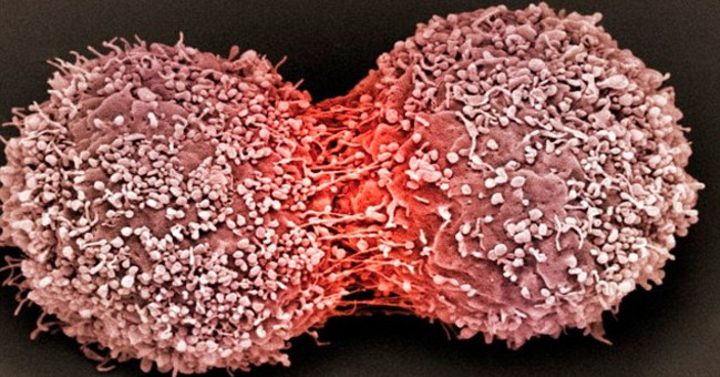 3 golden rules stop tumor formation in the body